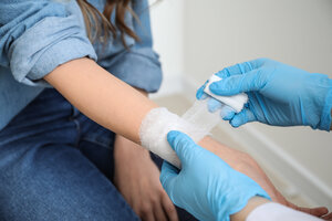 Burn Injury Attorney Atlanta