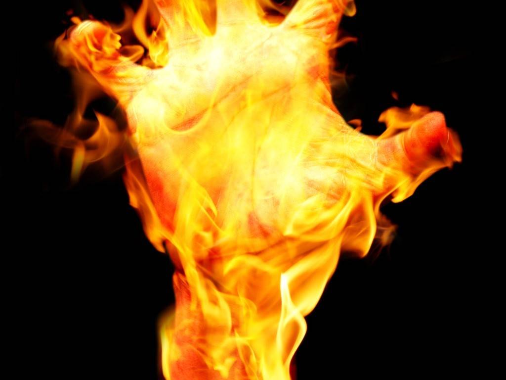 Burn Injuries