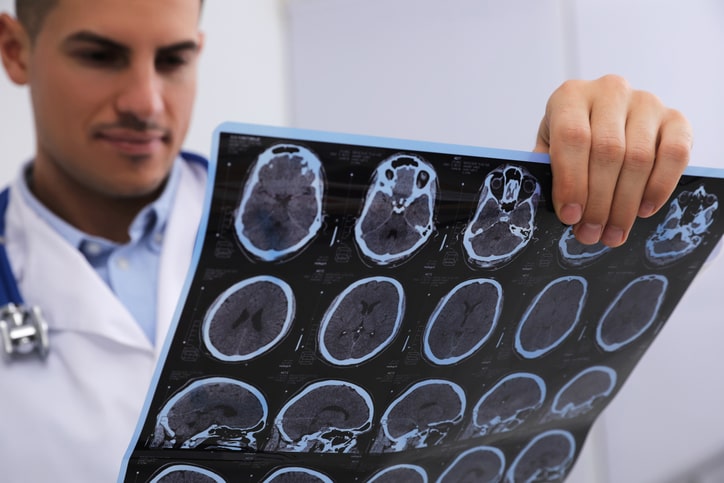 Brain Injury Law in Atlanta & Marietta
