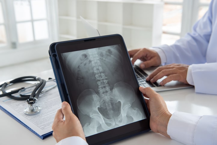 Psychological Effects of Spinal Cord