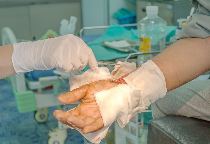 Life After Severe Burn Injuries