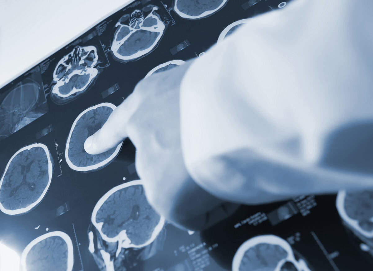 Brain injury report