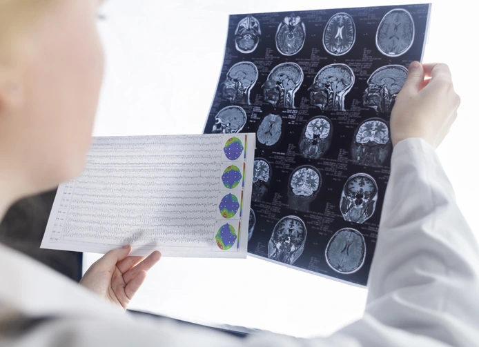 Brain Injuries in Marietta